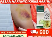 10 Luka Memar dan Bekas Penyiksaan yang Ditemukan di Tubuh Zahra Lantong, Ungkap Keluarga: Kami Lihat Sendiri