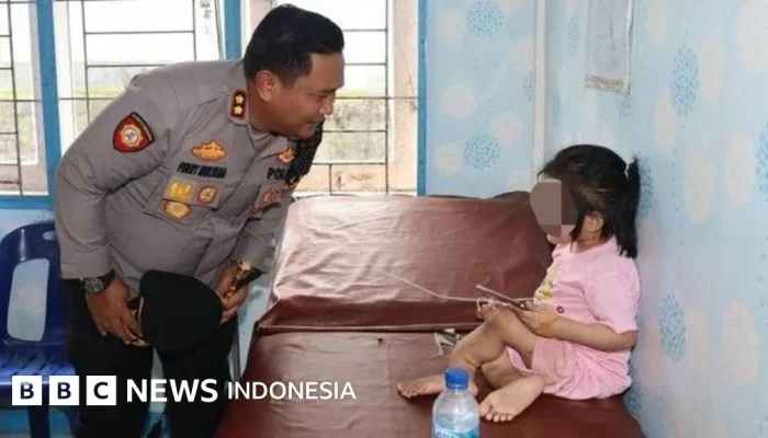 10 Luka Mengerikan yang Ditemukan di Tubuh Zahra Lantong, Tante Korban: Kami Lihat Sendiri