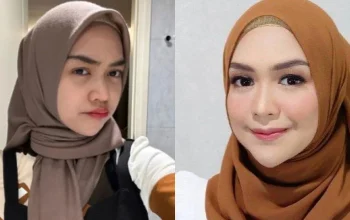 Ria Ricis Buka Tabir Operasi Hidung, Tur Kamar Pink, dan Misi Penangkap Ikan Sapu‑Sapu di Kali Ciliwung