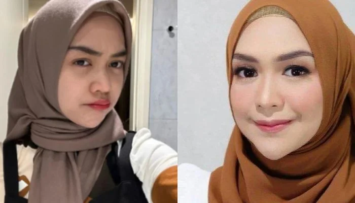 Ria Ricis Buka Tabir Operasi Hidung, Tur Kamar Pink, dan Misi Penangkap Ikan Sapu‑Sapu di Kali Ciliwung