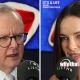 Abbie Chatfield dan Kontroversi di Sekitar Anthony Albanese